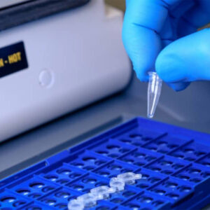 مزایای استفاده از دستگاه ترمال سایکلر (PCR) 